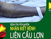 Quyết định Về việc ban hành “Hướng dẫn chẩn đoán, điều trị bệnh do liên cầu lợn (Streptococcus suis
